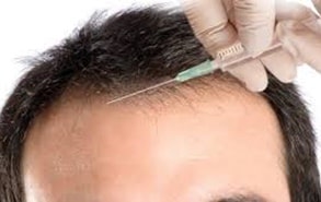 stem cell 