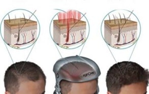 Laser Helmet