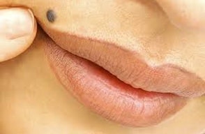 moles